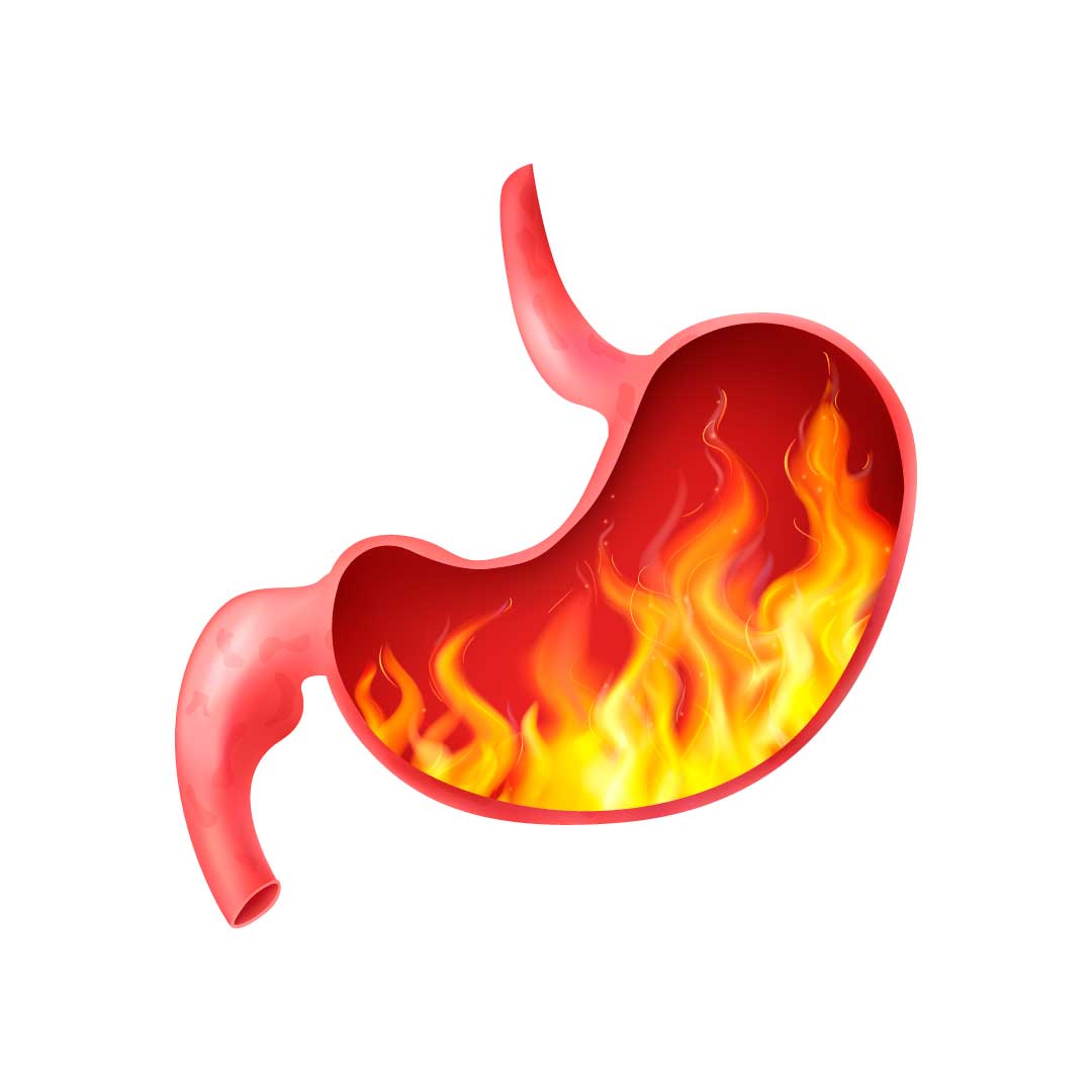 gastritis-un-sintoma-comun