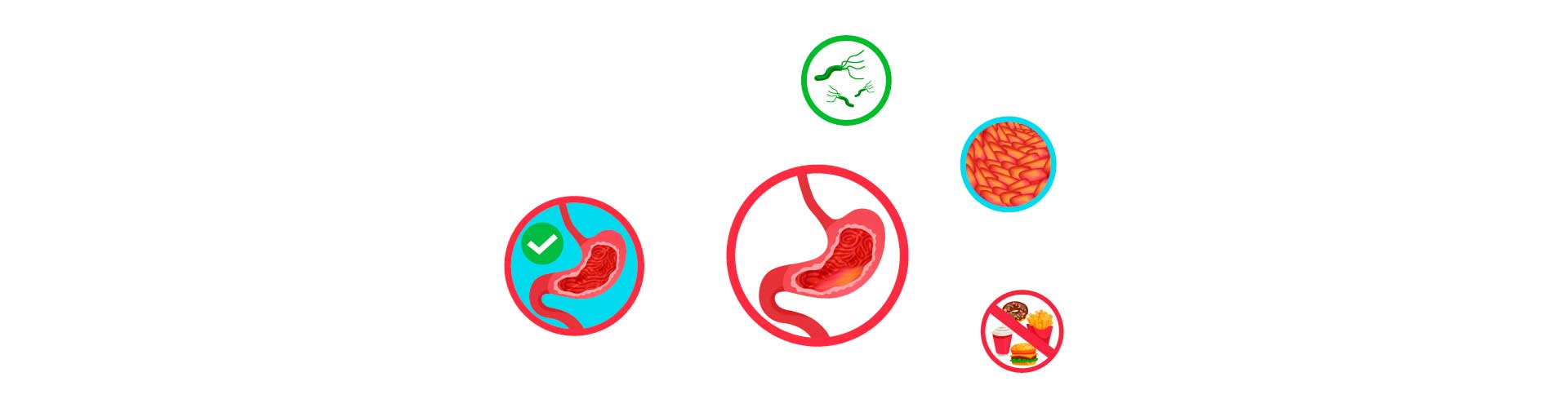 gastritis-y-como-se-ve-el-estomago