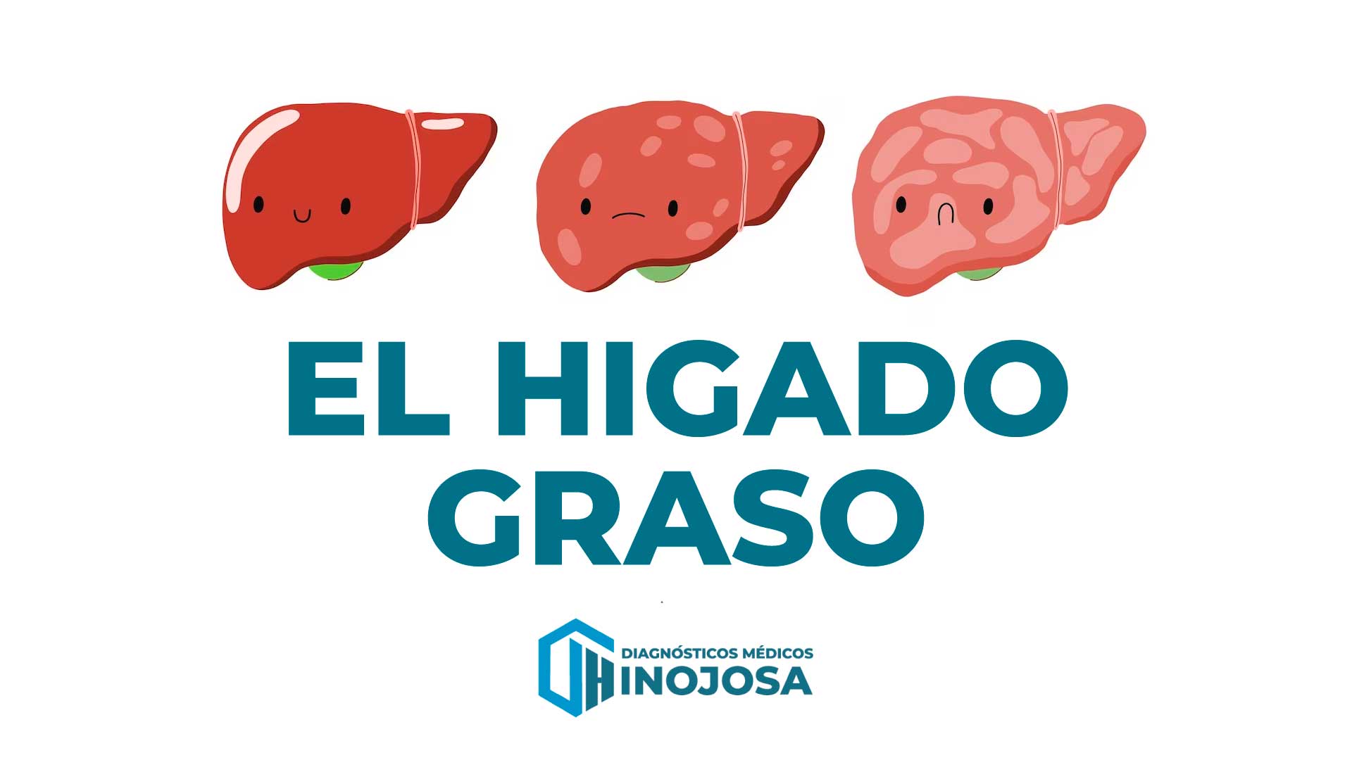 higado-graso-ecografias