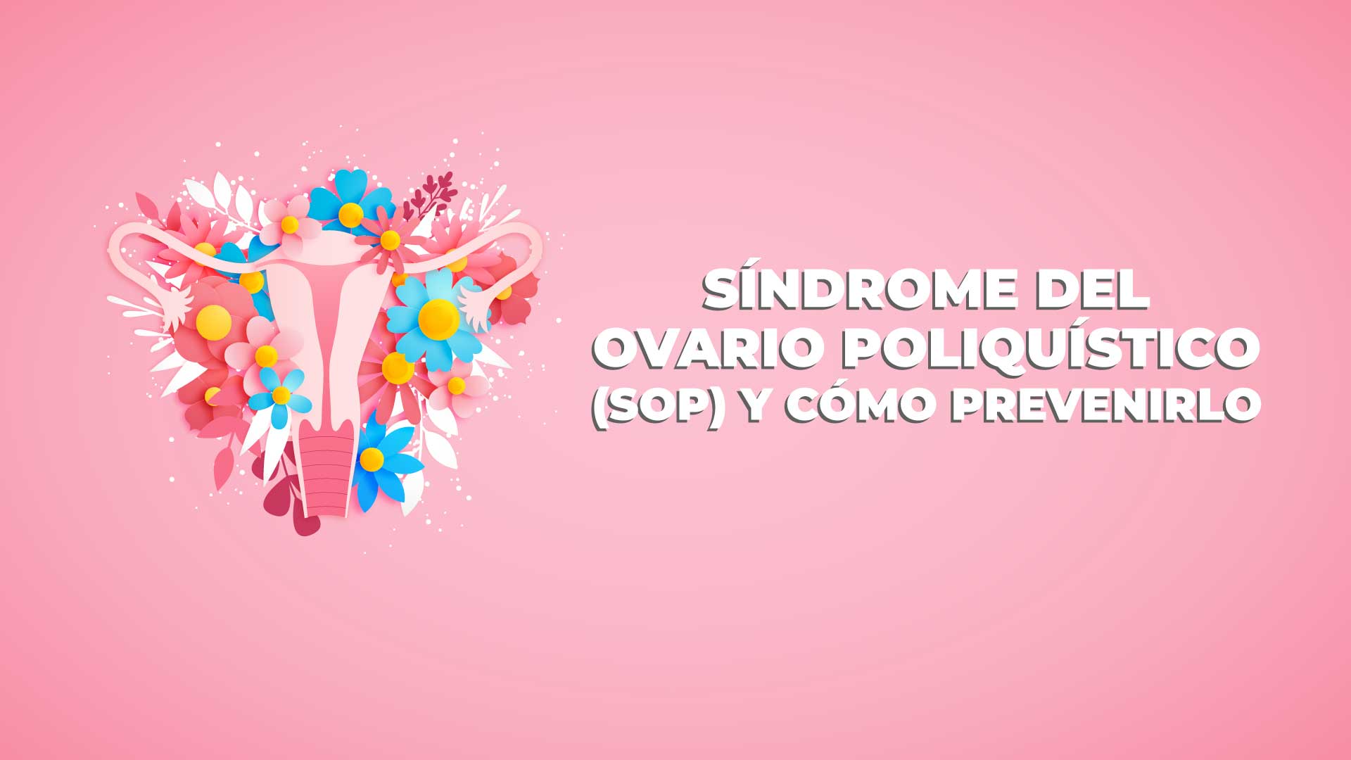 sindrome-de-ovario-poliquistico